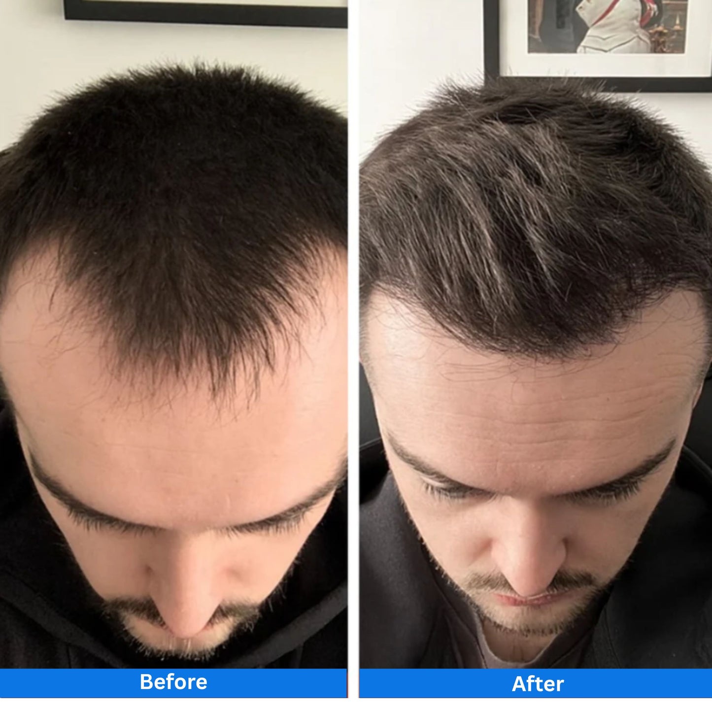 Hair Growth Serum for Thinning Hair & Hair Loss